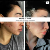 Lumara Systems — VISO - Anti-Aging Red Light Mask